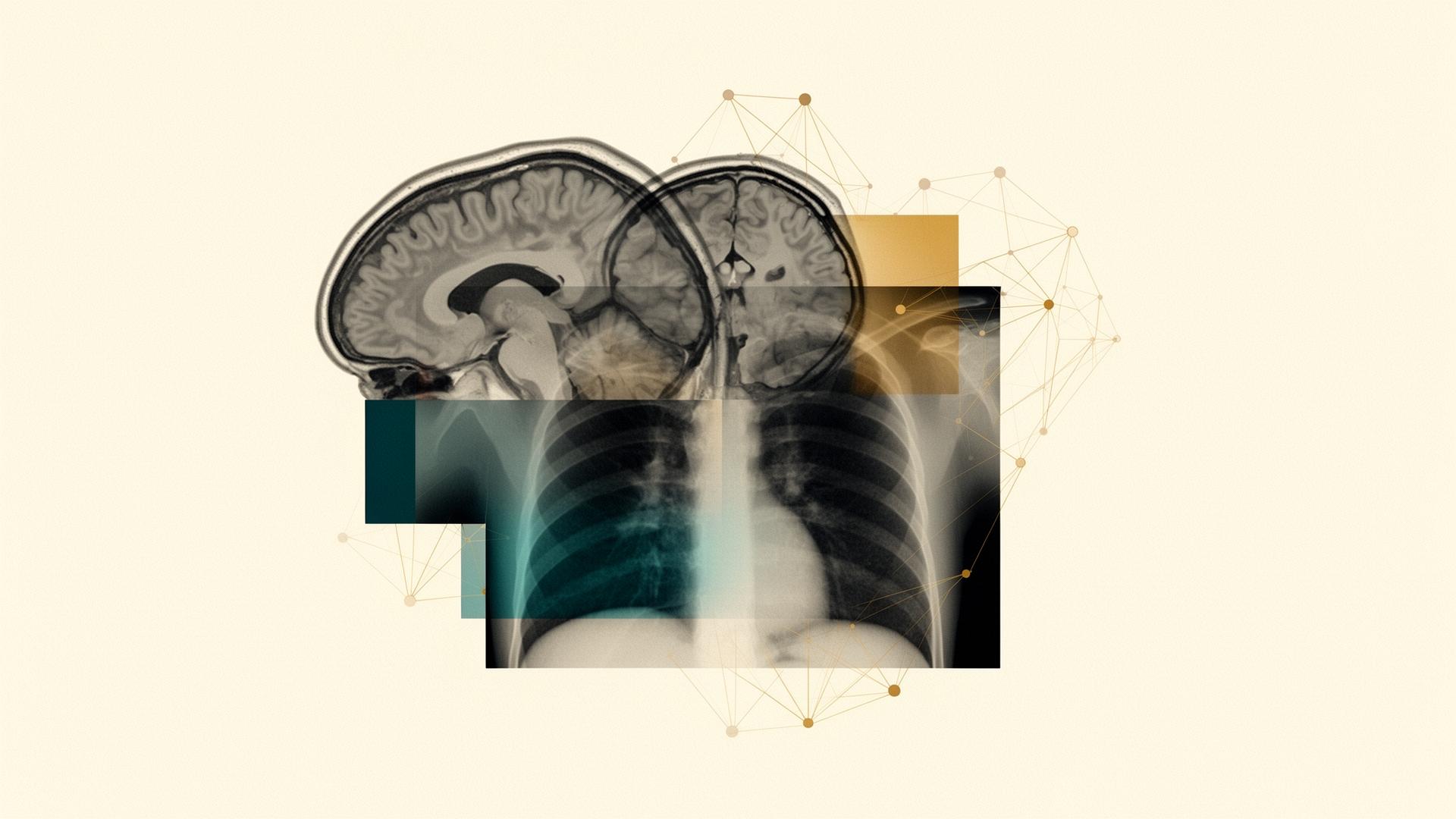 Multi-modality radiology composition